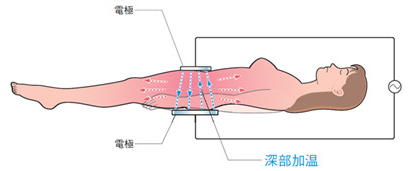 QQ截图20170916170133.png